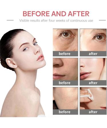 Natural Moisturizing Factors + HA 100ML Mens Facial Moisturiser Facial Moisturiser For Glowing Skin Sensitive Face Moisturiser Daily Skincare For Dry Skin Hydrating Anti Aging Face Cream - Buy Online on GoSupps.com