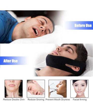 Adjustable Anti Snore Chin Strap - Stop Snoring Devices - Breathable Head Band - Blue&Black - Buy Online on GoSupps.com