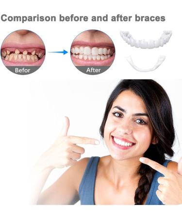 Toulifly Dental Prosthesis Veneer Teeth on Top and Bottom 3 Pairs of False Artificial Temporary Teeth Cosmetic Teeth Prosthetics Fake Teeth Teeth for Plugin Veneer Snapon Teeth White - Buy Online on GoSupps.com