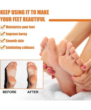 Foot Callus Removal Spray 2PCS - Instant Peel-Off Spray for Cracked Heels & Rough Skin - Orange Oil Hydrating Formula for Nourished Feet - Buy Online on GoSupps.com