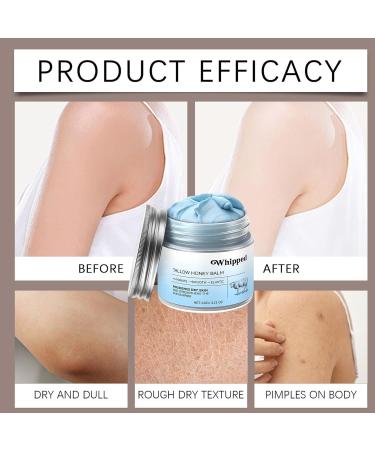Cr me Hydratante Visage | Soin Visage et Corps Naturel Nourrissant | 60g R parateur de Barri re Cutan e - pour Pieds Mains Secs Peaux Sensibles Grasse Nuit Matin Quotidien Nettoyant Hiver - Buy Online on GoSupps.com