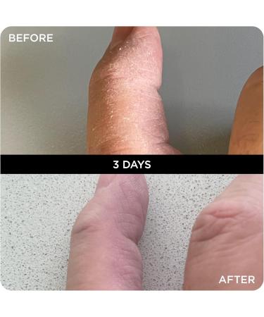 WONDERBALM LIMITED Multi Use Balm All in One Skin Cream Moisturizer for Hair Cuticles Lips and Body Moisturizing Fast Absorbing NonGreasy Olive Oil Shea Butter Vegan Natural Ingredients 20 ml - Buy Online on GoSupps.com