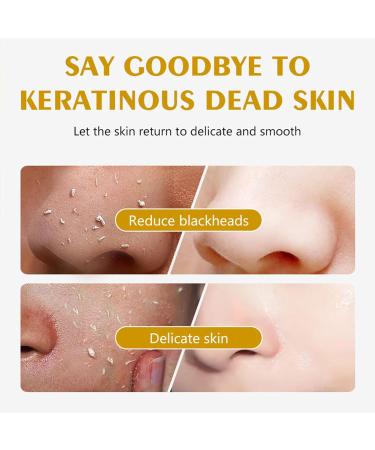 KOAHDE Exfoliating Whitening Gel Lemon Peeling Gel Lemon Face Exfoliator Gel Lemon Exfoliating Face Scrub Lemon Whitening Exfoliator Gel Face Scrub For Women Exfoliating Gel Brigtening Skin 100ML - Buy Online on GoSupps.com