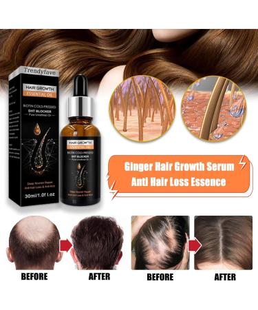 Trendyfave Hair Growth Oil Natural Herbal Hair Oils Ginger Hair Growth Serum and Enhancer Nourishing Scalp Hair Care Repair Dry & Restless Hair Serum Hair Thickening Oil for Thinning Balding Hair - Buy Online on GoSupps.com