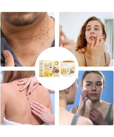 Bee Venoms Wart and Tag Remover - Bee Venoms Repair Cream - Skin Bee Venoms Tag Removal Cream - Bee Body Lotion - Tag Recede Bee Venoms Cream for All Skin - Intensive Body Lotion - Buy Online on GoSupps.com