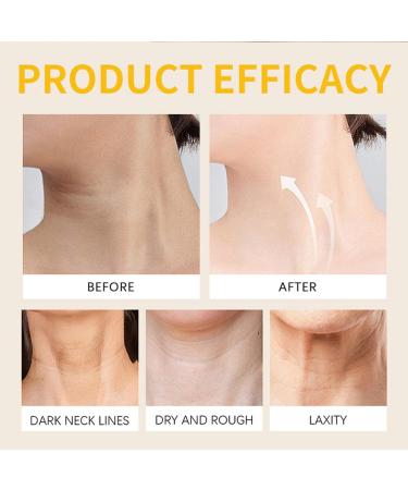 Bee Venom Cream for Face and Neck Anti-Aging Face Moisturizer with Honey and Hyaluronic Acid Day & Night Skincare Repair Cream for Fine Lines 1.7oz (50g) 1Pc - Buy Online on GoSupps.com