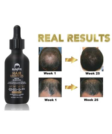ELEVATE Hair Growth Oil - Biotin & Minoxidil Serum for Stronger, Thicker Hair | Natural Treatment to Stop Thinning & Hair Loss - Men & Women 2oz - Buy Online on GoSupps.com