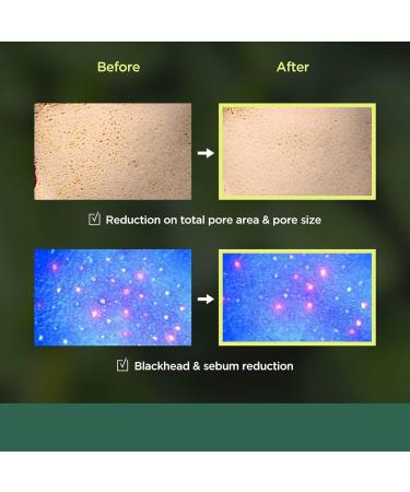 Heartleaf 77 Toner Pad - Exfoliating PHA Care for Dead Skin | 70 Sheets 160 ml - Low pH Daily Toner Peeling - Buy Online on GoSupps.com