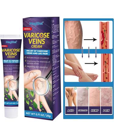  MagiSel Varicose Vein Cream Varicose Vein Cream Cream for Varicose Veins Varicose Vein Leg Treatment Suitable for Spider Veins Improves Blood Circulation Quickly Relieves Tired Legs 20g - Buy Online on GoSupps.com