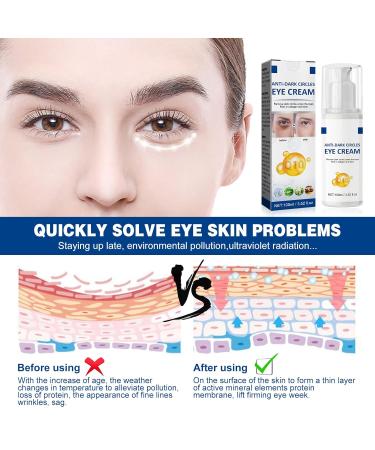 Allony Jasmine Ointment 100ml | Remove Dark Circles & Wrinkles - Best Eye Cream for Brightening - Buy Online on GoSupps.com