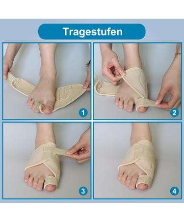 Hallux Valgus Correction Rail - Big Toe Pain Relief & Toe Alignment Bandage for Men & Women (Beige Right) - Buy Online on GoSupps.com