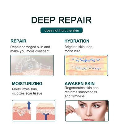 Silicone Scar Sheets 1.6 x 120 Large Roll - Waterproof Soft Strips for Acne, C-Section, Keloid, and Burn Scars - Skin Care - 10-12 Month Supply - Buy Online on GoSupps.com