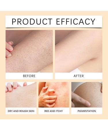 Shantou Youjia 150 ml Body Lotion whitening body cream skin calming body lotion body care for sensitive and very dry skin for an even and radiant complexion - Buy Online on GoSupps.com