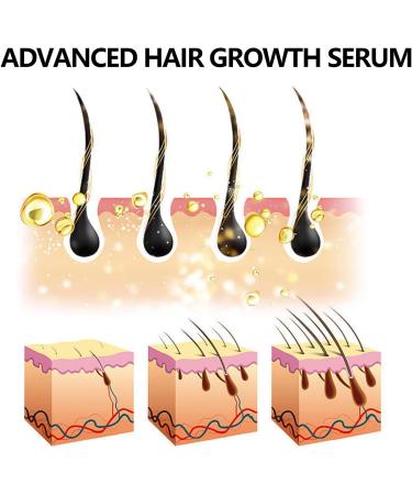 Hair Growth Serum Organic Castor Oil Anti Hair Loss Hair Serum for Thinning Balding Thin Hair Fast Growth Strengthen Hair Roots for Men & Women Damaged Hair Repair - Buy Online on GoSupps.com