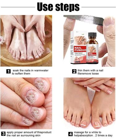 TLOPA Intense Nail Growth and Strengthening Serum 7 Days Nail Growth and Strengthening Serum Nail Serum Repair Essence for Damaged Nails (3Pcs) - Buy Online on GoSupps.com