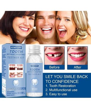 Temporary Tooth Filling Repair Kit - Dental Tooth Filler for Missing or Broken Teeth - Buy Online on GoSupps.com