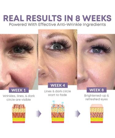 Buy Lambo 5 PCs 15ml Eye Cream - Japan Neutro-Confident Peptide Essence for Dark Circles & Tear Bags - International Shipping Available - Buy Online on GoSupps.com