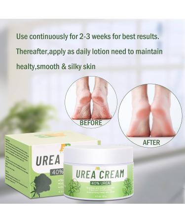 SOURCE LEAF 40% Urea Cream for Cracked Heels - 4.3 fl.oz - Foot Care Lotion for Softening Rough Skin - Men and Women - Buy Online on GoSupps.com
