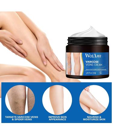 WosAna Varicose Vein Cream - Natural Spider Veins Treatment for Improved Leg Appearance and Circulation - Buy Online on GoSupps.com