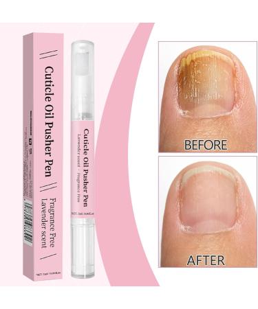 Stylo Repousse-cuticules L'huile Cuticle Oil Pusher Pen 2 En 1 Cuticle Remover Dissolvant De Cuticules Et Huile Pour Ongles Aux Parfums Rose Et Lavande Pour Soin De Manucure De Femmes - Buy Online on GoSupps.com