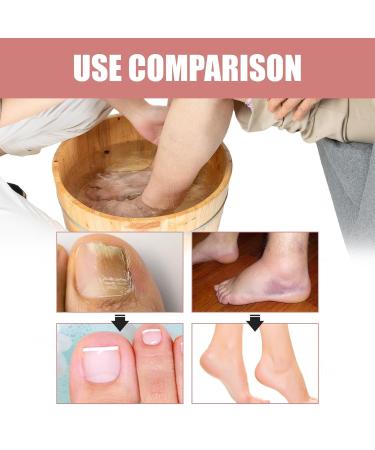 Foot Bath Essential Oil | Natural Herbal Care for Toenails Dead Skin & Relaxation | Effective Foot Care Products - Buy Online on GoSupps.com