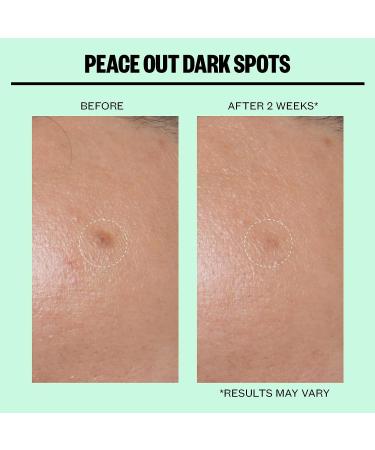 Peace Out Skincare Dark Spot Microneedling Dots - 12 Dots for Clear, Even Skin - Buy Online on GoSupps.com