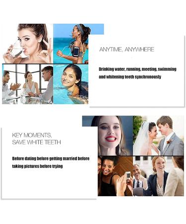 Provisional Dentures | Immediate Smile Teeth Prosthesis | 2 Pairs Cosmetic Veneers | Temporary Upper & Lower Snap-On Prostheses for Bad Teeth - Buy Online on GoSupps.com