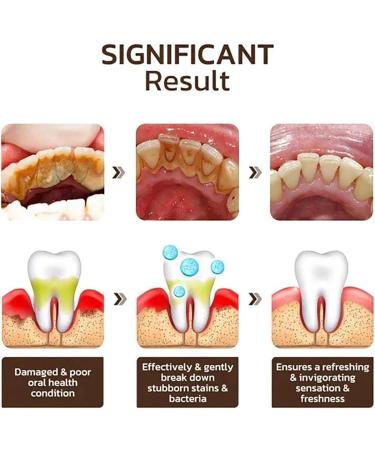 Xoermioy Niacinamide Whitening Toothpaste Body Accel Niacinamide Whitening Toothpaste Body Accel Toothpaste Dazzling White Toothpaste Niacinamide Toothpaste Teeth Whitening Toothpaste (2PCS) - Buy Online on GoSupps.com