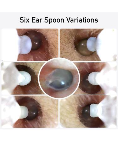 EarScope Ear Cleaner Wireless Otoscope with Camera & LED Light Ear Wax Removal Kit for All Ages Best Ear Care Products for iPhone & Android - Buy Online on GoSupps.com