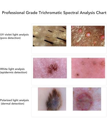 D tecteur de Cuir Chevelu de Cheveux de Peau D tecteur de Cuir Chevelu de Cheveux D tecteur de Follicule Pileux de Cuir Chevelu 800x D tecteur de Cuir Chevelu de Cheveux avec 2MP - Buy Online on GoSupps.com