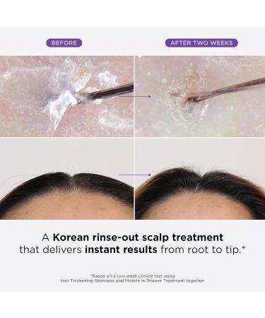 Dr. Groot Miracle in Shower Treatment | Korean Hair Care | 5 Seconds to Smooth Hair with Rosemary Oil | Moisturizing Scalp & Hair Rinse | K-beauty Revitalizing Solution - Buy Online on GoSupps.com