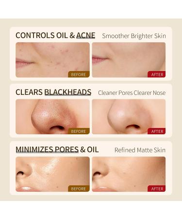 SACELLEC BEAUTE Amino Acid Facial Cleanser Deep Cleansing Pore-Minimizing Oil-Control Acne-Fighting Facial Wash for Women and Men 4.06 oz - Buy Online on GoSupps.com