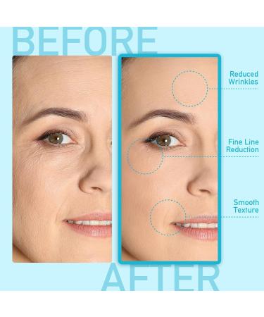 Retinol Stick for Face & Eye - Anti-Wrinkle Hydrating Cream & Multi-Balm for Fine Lines | Anti-Aging Daily Moisturizer - Buy Online on GoSupps.com