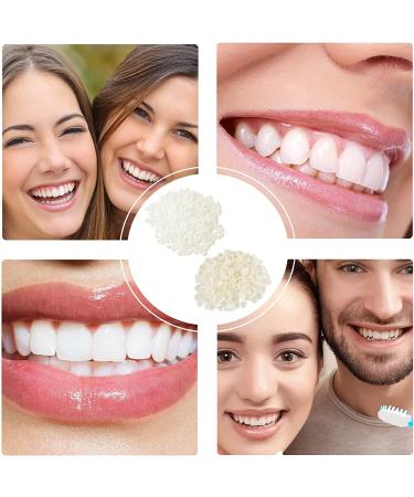 Temporary Tooth Replacement Kit - DIY Front Teeth Dental Veneer with Thermal Beads (100 Pieces) - Buy Online on GoSupps.com