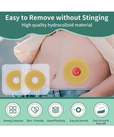 20PCS 2mm Moldable Ostomy Barrier Rings for Better Seal - Medical Grade Adhesive Ostomy Supplies - Buy Online on GoSupps.com