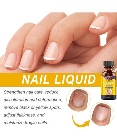 Fungal Nail Treatment For Toenails Extra Strong - Nail Fungus Treatment - Moisturize Cuticle Care Oils for Ingrown Toenails - Toenail Growth for Repairing Damaged & Discolored Nails(30ML) - Buy Online on GoSupps.com