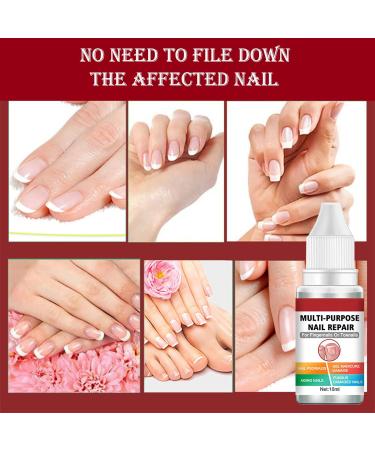 Fungal Nail Treatment Solution - Extra Strong Repair for Toenails & Fingernails - Safe & Effective - 2pcs x 1.00 ml - Buy Online on GoSupps.com