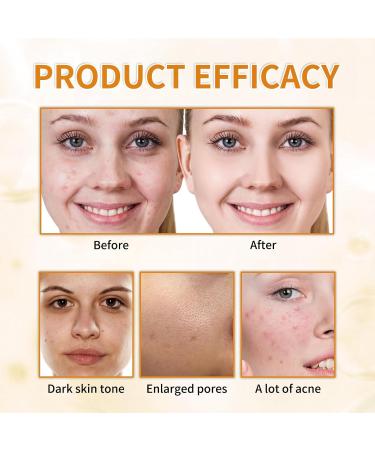 7% Glycolic Acid Exfoliating Toner Exfoliating Facial Toner Pore Minimizing Toner Smooth Skin Even Tone Hydrating Formula 3.38 Fl Oz (Pack of 1) - Buy Online on GoSupps.com