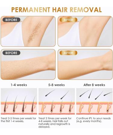 IPL Laser Hair Removal Device for Women & Men - Painless Permanent Hair Remover for Whole Body & Face - 999 999 Flashes - Buy Online on GoSupps.com