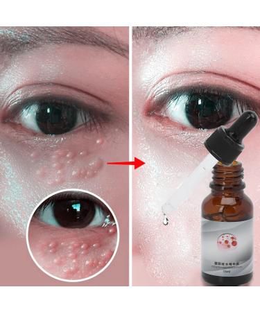 Repairing Eye Cream & Moisturizing Eye Oil Granules - Anti-Aging Serum for Dark Circles & Eye Care (15ml) - Buy Online on GoSupps.com