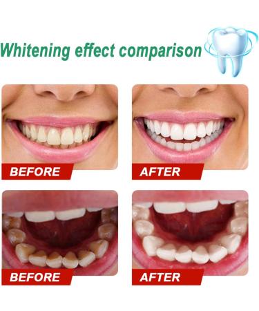 KLYso Premium Teeth Whitening Powder - Natural Oral Care Solution to Remove Stains Freshen Breath & Brighten Teeth - 100% Safe & Effective Dental Whitener(3PCS) - Buy Online on GoSupps.com