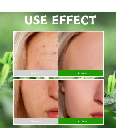 Tea Tree Face Scrub Face Exfoliator Tea Tree Body Scrub Body Exfoliator Moisturizing Body Spa Care Face Skin Care Scrub For Bikini Area Neck Butt Back Acne Armpit Dry & Dull Skin - Buy Online on GoSupps.com