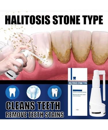 Mouth Shower Test Winner | Calculus-Free Deep Cleaning Foam & Stain Removal Tooth Spray - 30ml White - Buy Online on GoSupps.com