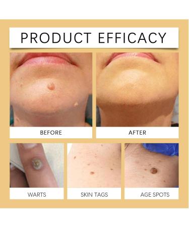  Generisch Skin Care Cream | 50g Natural Repair Body Cream Firming Moisturizing Lotion for Women Men Teenagers Morning and Evening After Shower for the Office - Buy Online on GoSupps.com