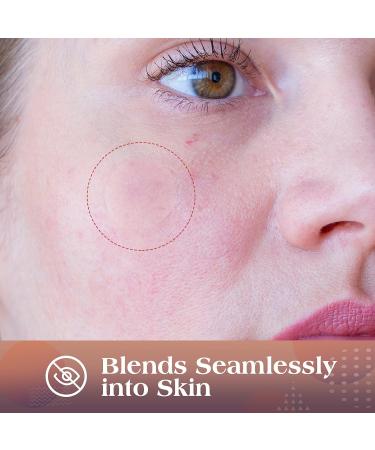 AUSLKA Blemish Patches - 4 Size (174 Patches) - Hydrocolloid Blemish Patch - Invisible Spot Cove - Spot Dots - for Face Zit Patches 175 Count (Pack of 1) - Buy Online on GoSupps.com