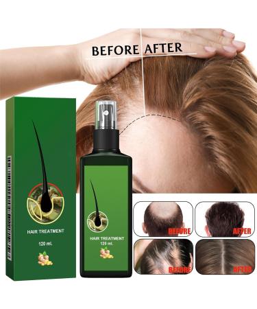 Shantou Yingji Nourishing Ginger Nourishing Spray Ginger Hair Growth Serum AntiHair Loss 2 Pieces x 120 ml - Buy Online on GoSupps.com