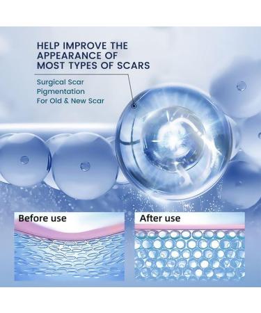 RedOceansM Scar gel scar removal cream scar care gel scar repair cream stretch mark creams remover 20 g scar ointment after use natural scar gel reduces the visibility of - Buy Online on GoSupps.com
