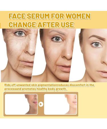 Turmeric Dark Spot Correcting Serum Niacinamide Serum Hydrating Serum Anti Aging Brightening Face Serum For Pure Skin Glow Face Serum Reduce Wrinkles Acne For Face Moisturizes Face Skincare - Buy Online on GoSupps.com