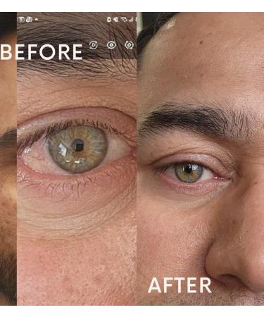 Luxyh Dynamic Firming Eye Cream | Under Eye Cream For Puffiness And Fine lines Under Eyes | Isopropyl Myristate + Squalene + Citric Acid | Hydrating - Buy Online on GoSupps.com