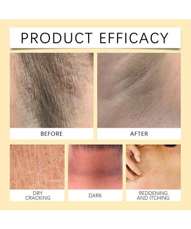 IZBEAUVO Skin Brightening Capsules Vitamin E Capsules For Face Vitamin E Oil For Skin Firming Hydrating Serum Reduce Fine Lines Skin Brightening Anti Wrinkle Face Serum 30 Capsules - Buy Online on GoSupps.com